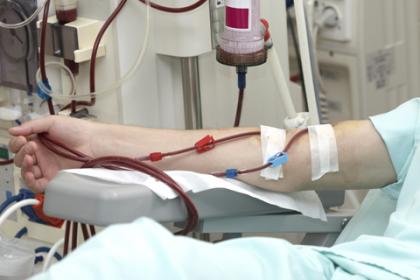 Patient arm receiving dialysis